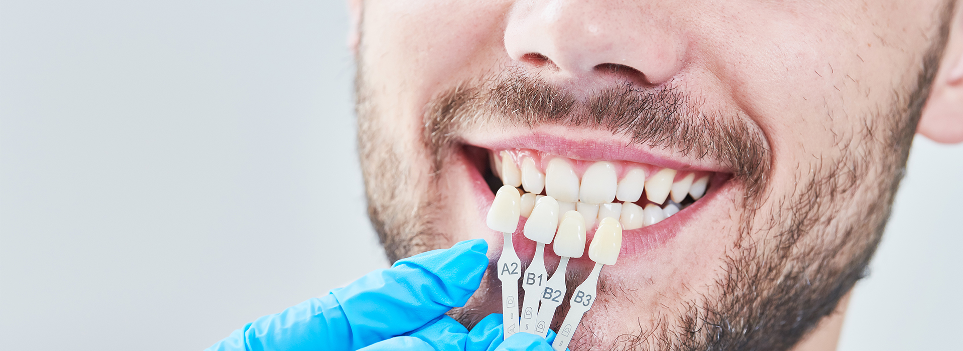 The image shows a person with a toothy smile holding a dental mirror, with a focus on their mouth and teeth, and they are wearing a blue surgical gown.