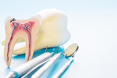 The image shows two side-by-side photographs on the left, a toothbrush with a toothpaste tube and a dental pick on the right, a close-up of a tooth model with a cavity and a dental implant in place, displayed next to a pair of tweezers with a loop.